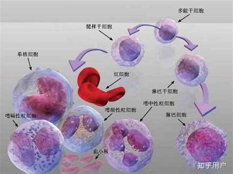mds是什么病(骨髓增生异常综合征mds是什么病)