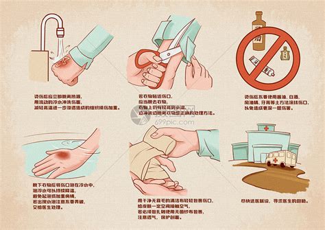 烫伤要怎么办(烫伤之后怎么处理)
