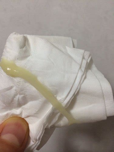 阴道一使劲就会流水粘液无色透明