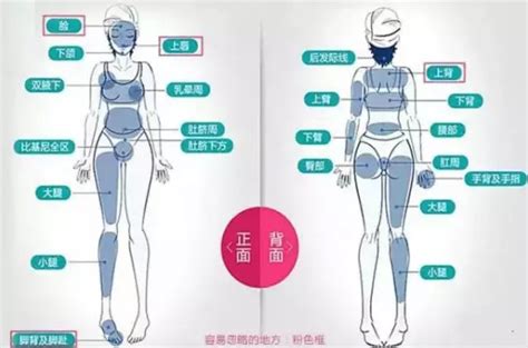 全身激光脱毛的价格多少