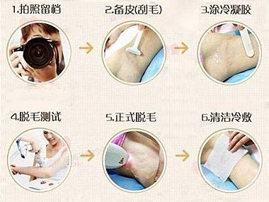 全身脱毛一般多少钱啊