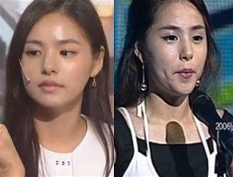 闵孝琳整容前后照片对比 女神闵孝琳整容旧照大曝光
